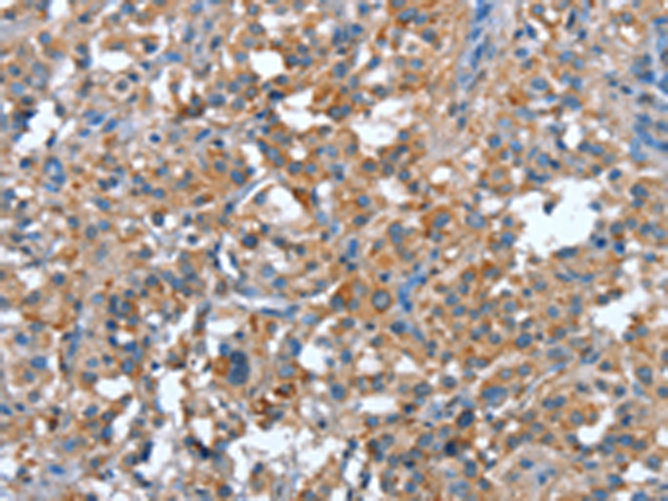 Rabbit Polyclonal Antibody to PLA2G6