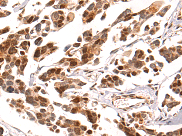 Rabbit Polyclonal Antibody to CAMTA1