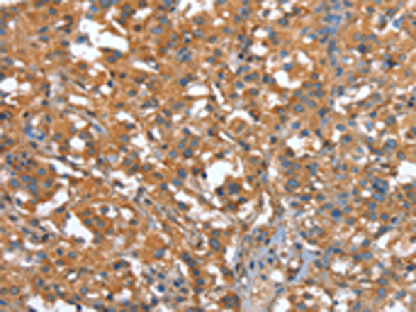 Rabbit Polyclonal Antibody to CAPZA1