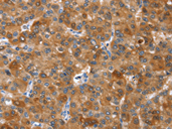 Rabbit Polyclonal Antibody to NOD2