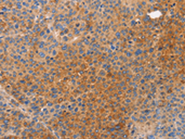 Rabbit Polyclonal Antibody to NOD1