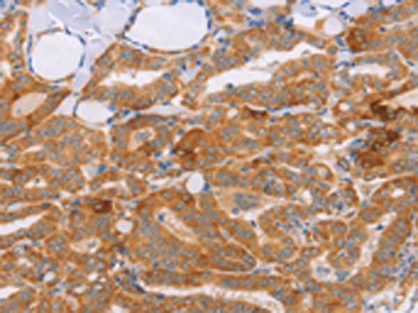 Rabbit Polyclonal Antibody to CARD6