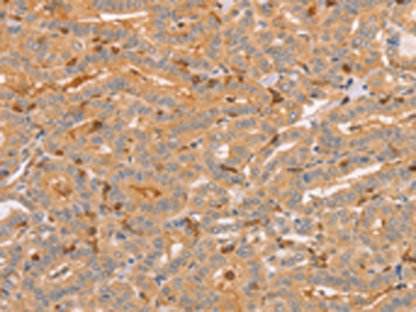 Rabbit Polyclonal Antibody to CCL16
