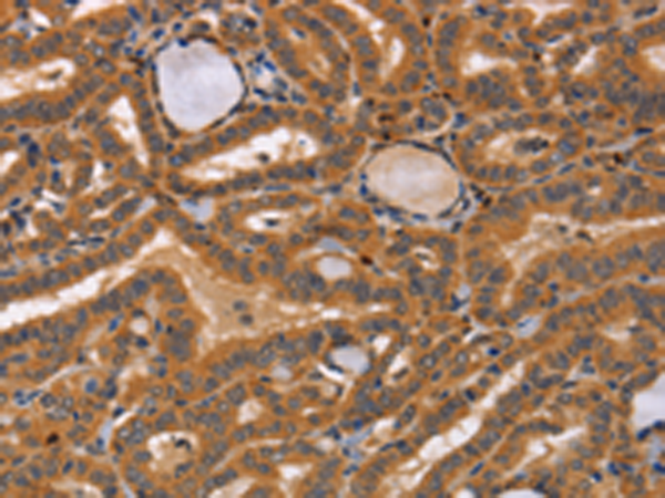 Rabbit Polyclonal Antibody to CCL23