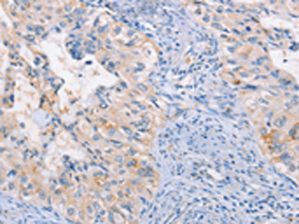 Rabbit Polyclonal Antibody to CCR5