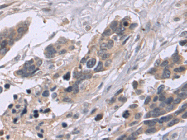 Rabbit Polyclonal Antibody to CD24