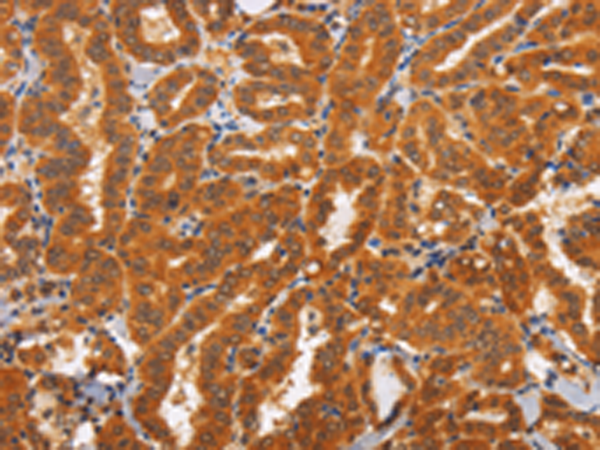 Rabbit Polyclonal Antibody to TNFRSF8