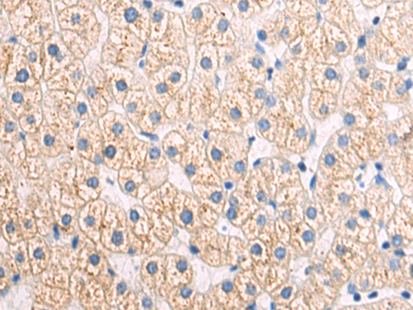 Rabbit Polyclonal Antibody to NCR1