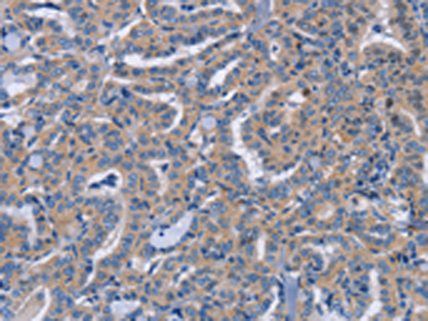 Rabbit Polyclonal Antibody to NCR2