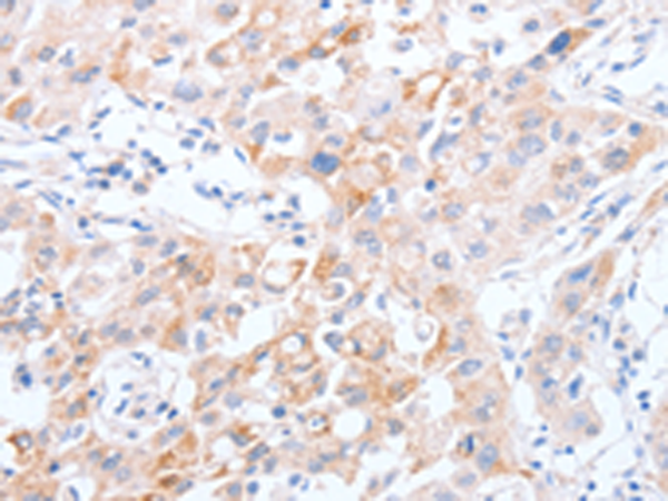 Rabbit Polyclonal Antibody to SCARB1