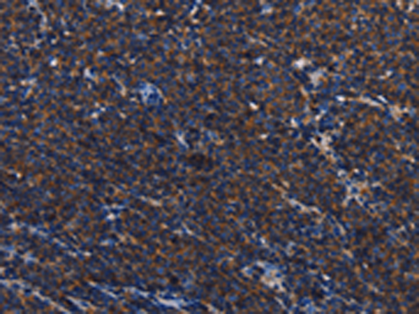 Rabbit Polyclonal Antibody to PTPRC