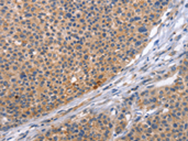 Rabbit Polyclonal Antibody to CD5L