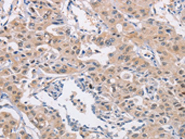 Rabbit Polyclonal Antibody to CDC34