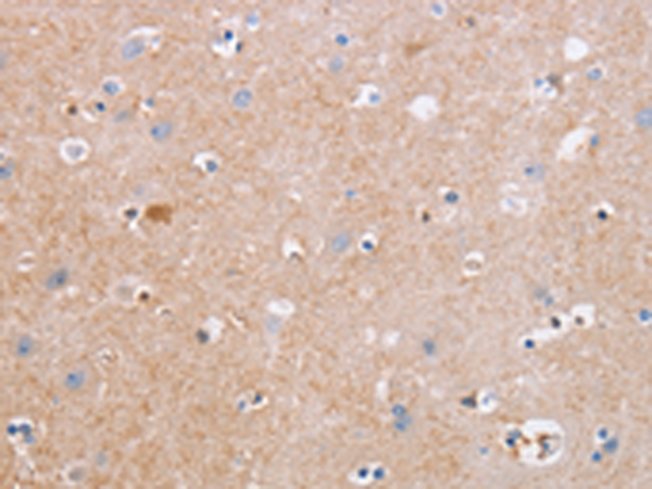 Rabbit Polyclonal Antibody to CDC7