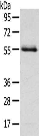 Rabbit Polyclonal Antibody to NUF2