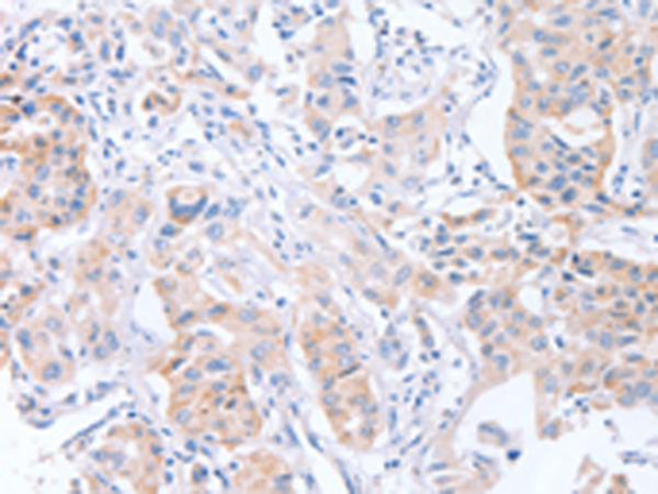 Rabbit Polyclonal Antibody to CDCA4
