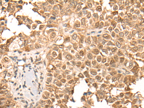 Rabbit Polyclonal Antibody to CDCA5
