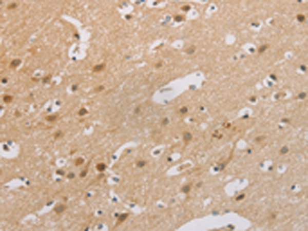 Rabbit Polyclonal Antibody to CDKN2A