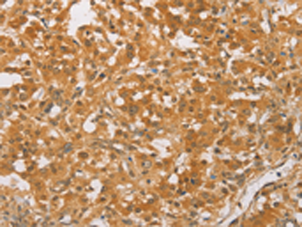 Rabbit Polyclonal Antibody to CEBPB