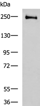 Rabbit Polyclonal Antibody to CENPE