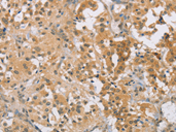 Rabbit Polyclonal Antibody to CENPF