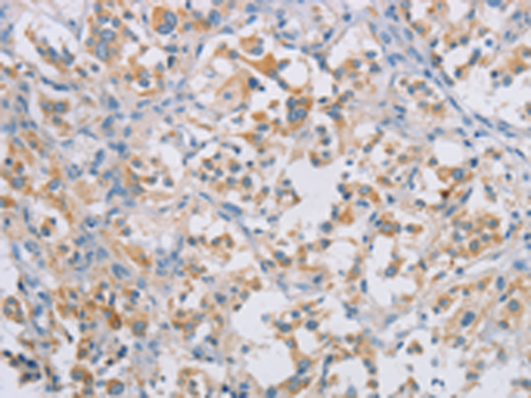 Rabbit Polyclonal Antibody to CERKL