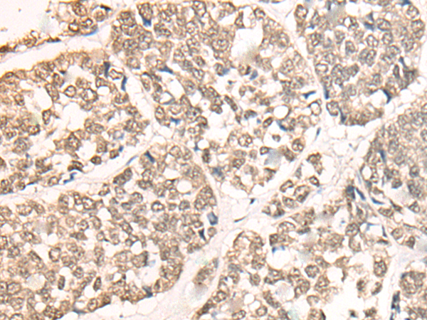 Rabbit Polyclonal Antibody to CHFR