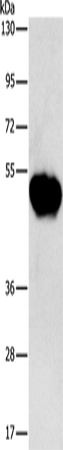 Rabbit Polyclonal Antibody to CHRDL2