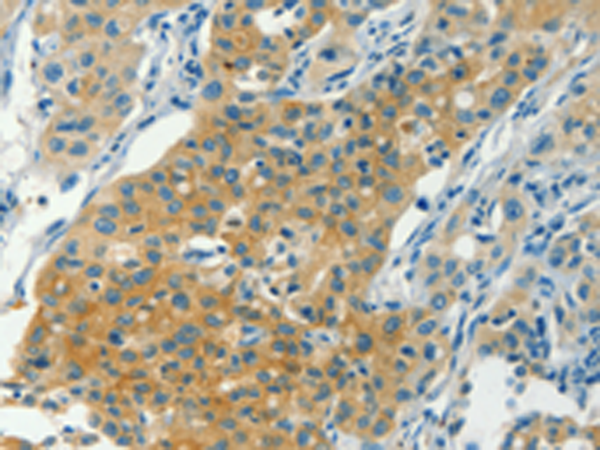 Rabbit Polyclonal Antibody to CHRNA2