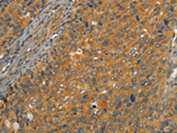 Rabbit Polyclonal Antibody to CIB1