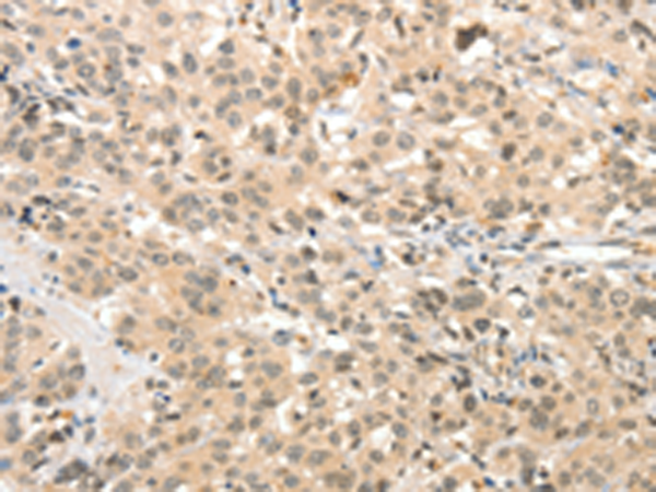 Rabbit Polyclonal Antibody to TSPYL2