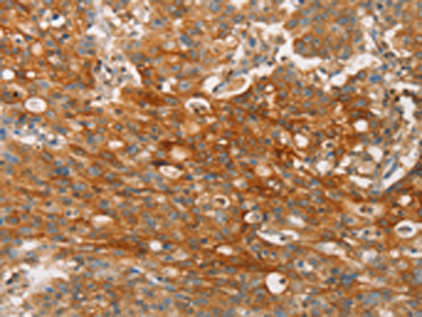 Rabbit Polyclonal Antibody to CLDN11