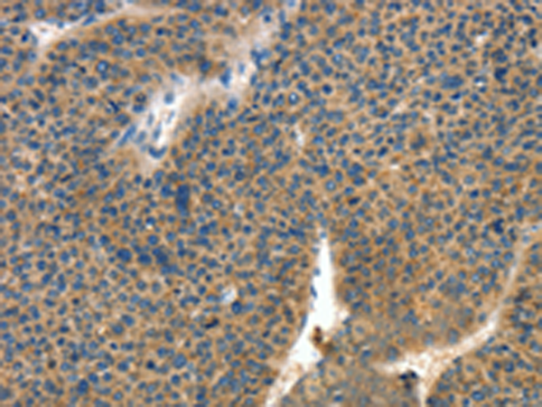 Rabbit Polyclonal Antibody to COL4A2
