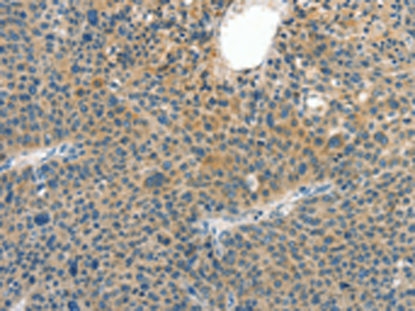 Rabbit Polyclonal Antibody to CRLF2