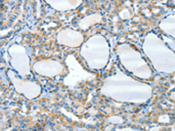 Rabbit Polyclonal Antibody to HID1