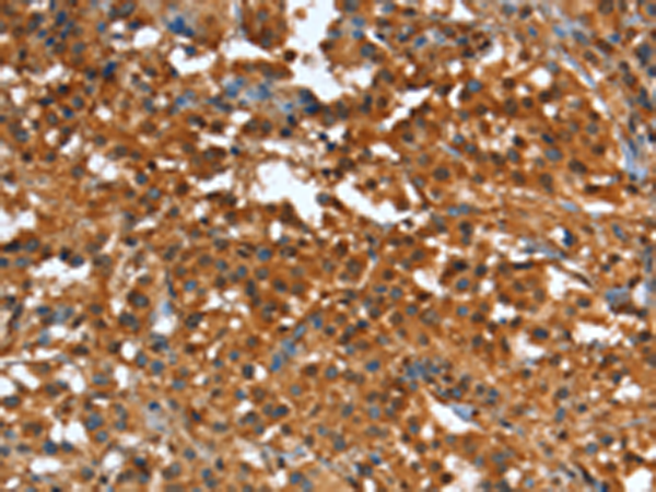 Rabbit Polyclonal Antibody to CR1