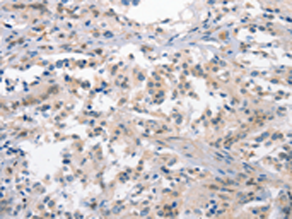 Rabbit Polyclonal Antibody to CRHR1
