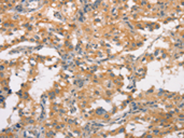 Rabbit Polyclonal Antibody to CRHR2