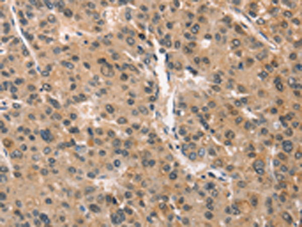 Rabbit Polyclonal Antibody to CRIM1