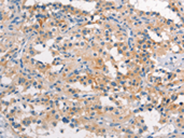 Rabbit Polyclonal Antibody to TDGF1