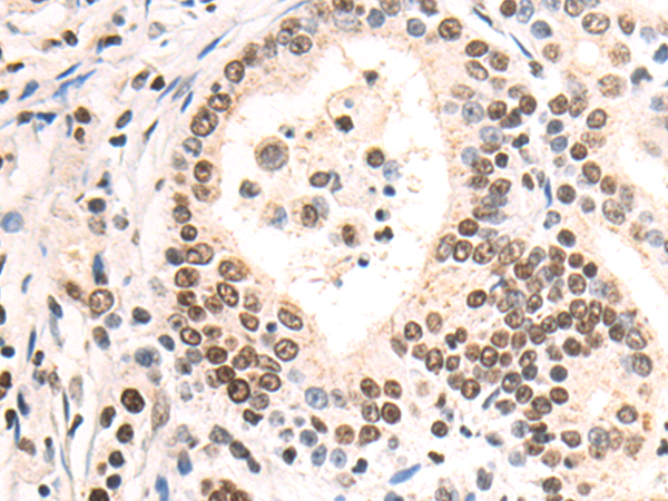 Rabbit Polyclonal Antibody to CDK12
