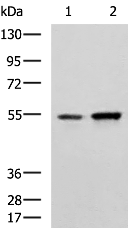 Rabbit Polyclonal Antibody to CALCRL