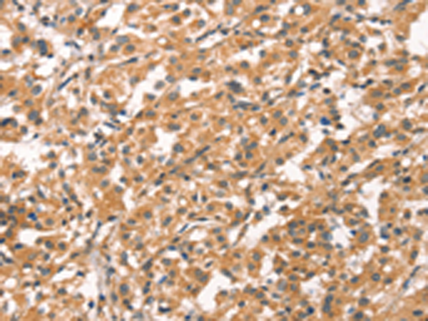 Rabbit Polyclonal Antibody to CYP46A1