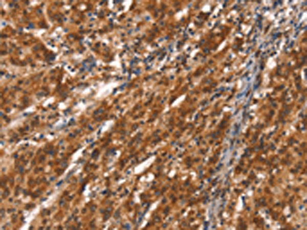 Rabbit Polyclonal Antibody to CYP2D6