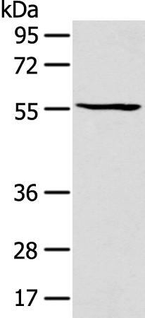 Rabbit Polyclonal Antibody to PTGIS