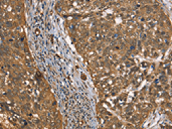 Rabbit Polyclonal Antibody to CSTB