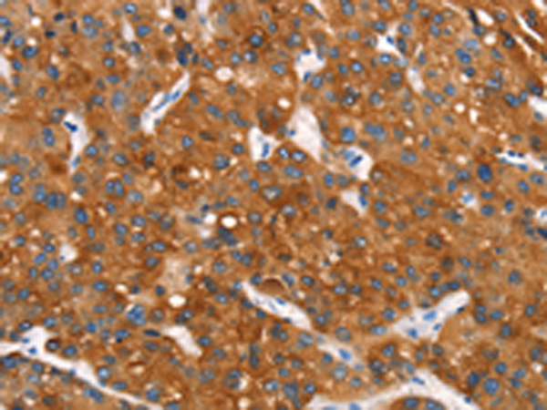 Rabbit Polyclonal Antibody to MT-CYB