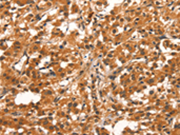 Rabbit Polyclonal Antibody to CYP2B6