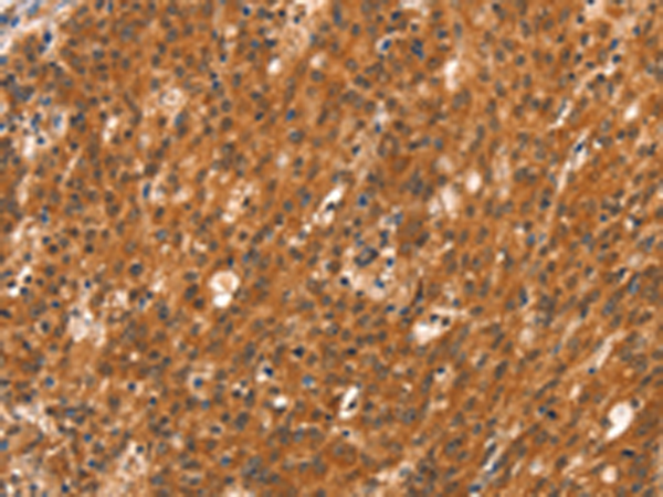 Rabbit Polyclonal Antibody to DAB2IP
