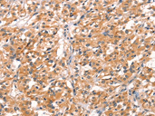 Rabbit Polyclonal Antibody to RHOBTB2